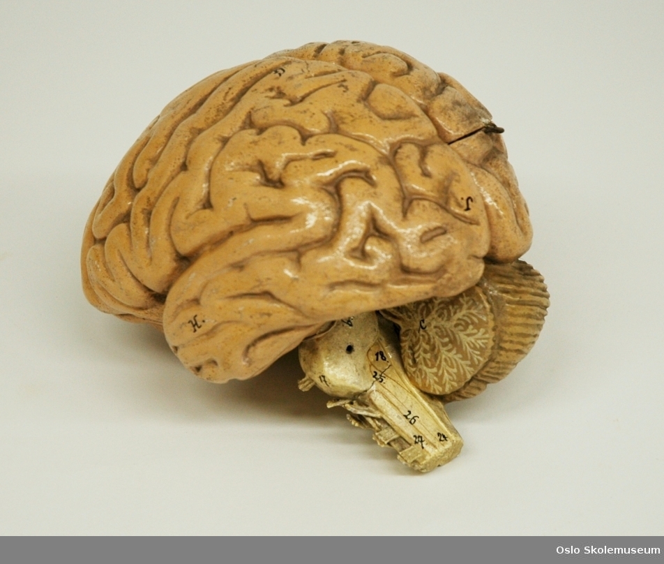 Undervisningsmodell av hjernen til et menneske i naturlig størrelse. Modellen består av tre deler (ABC) som kan taes fra hverandre for å se hvordan hjernen ser ut på innsiden. Delene festes sammen ved hjelp av små pinner i metall. De ulike delene i hjernen er merket med tall og bokstaver.