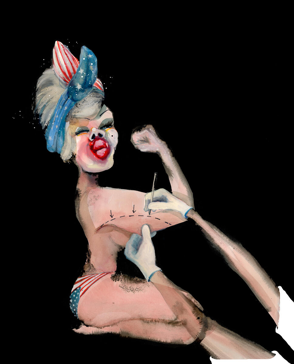 Karikaturtegning av den typiske amerikanske plakaten for feminisme, der en dame i arbeidsoverall med et rutete skaut bundet rundt hodet flekser muskel under banneret "We can do it". I denne tegningen har damen amerikansk flagg som skaut, botox-store lepper og kirurgisk inngrep på kroppen.