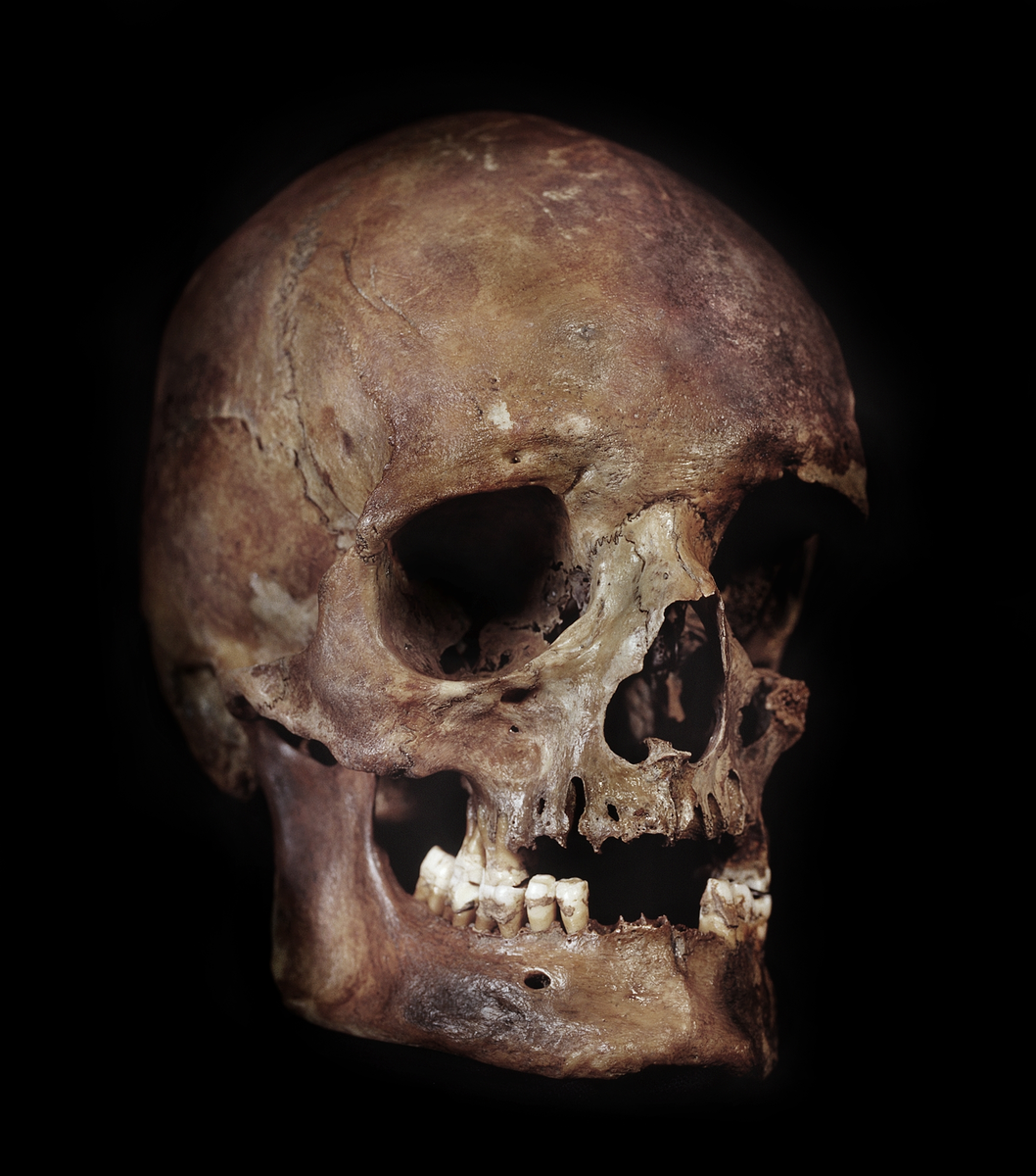Kranium med 3 tänder. Vänster sida skör och trasig.