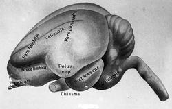 Dr. Magnus (Hjernen)