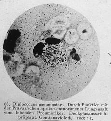 Mikroskopbilde, diplococcus pneumoniae, 1000:1.