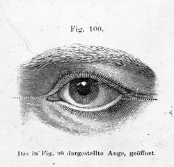 Anatomi; Øyet. Øyespalten, åpen.