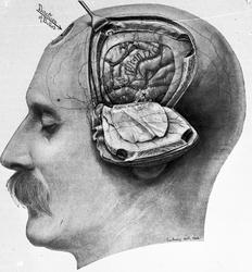 Dr. Magnus (Hjernen)